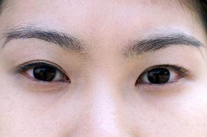 堺市の入れ歯治療も可能な歯医者さん